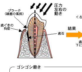 ピカピカな歯