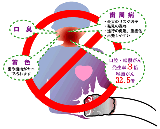 口臭　着色（歯や歯肉がヤニで汚れます）　歯周病（・最大のリスク因子　・発見の遅れ　・進行の促進、重症化　・再発しやすい）　口腔・咽頭がん発生率3倍　喉頭がん32.5倍