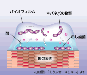 バイオフィルム　ネバネバの物質　むし歯菌　酸　歯の表面　花田信弘　「もう虫歯にならない」より