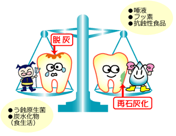 脱灰→●う蝕原生菌　●炭水化物（食生活）　再石灰化→●唾液　●フッ素　●抗蝕性食品