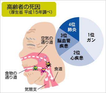 高齢者の死因（厚生省　平成15年調べ）　1位　ガン　　2位　心疾患　　3位　脳血管疾患　　4位肺炎　　空気の通り道　食物の通り道　食道　気管支