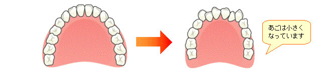 あごは小さくなっています