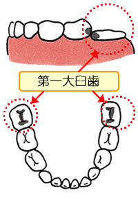 第一大臼歯