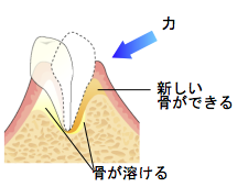 歯周病治療のプロセス