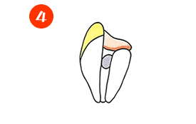 歯の根っこ4