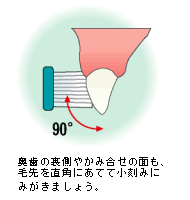 歯の裏側2