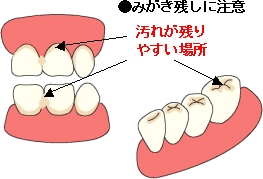 バス法