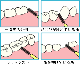 歯間ブラシの使い方