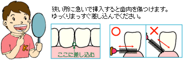 歯間ブラシの使い方