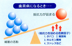 歯周病と全身のかかわり