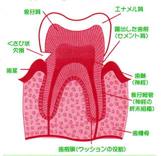 セメント質が露出したとき