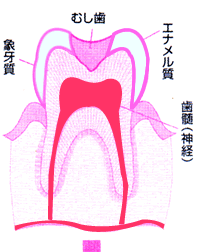 第二象牙質