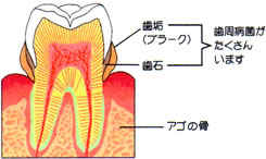 画像：プラークの説明