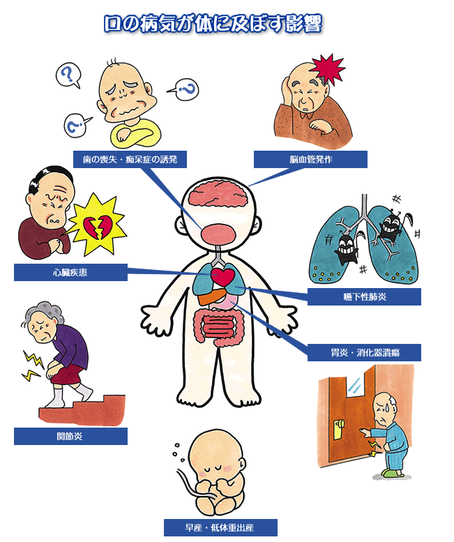 口の病気が体に及ぼす影響