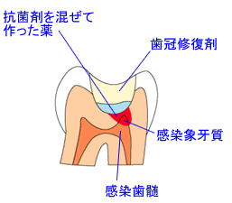 �R�ۍ܂������č������@�����C���܁@�����ۉ县�@��������