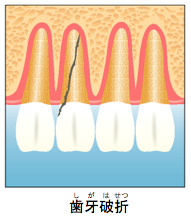 摜Fj܂̃C[W