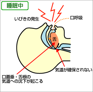 秋田 歯科 歯医者 南浦歯科クリニック 一般歯科 小児歯科 歯周治療 矯正治療 ホワイトニング パタカラ